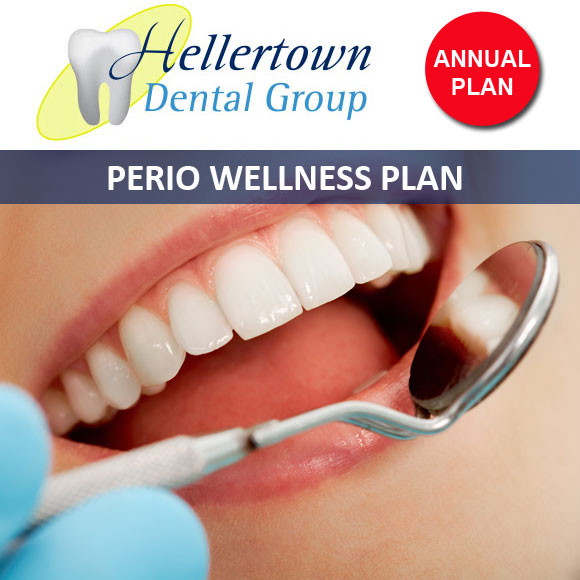 HDG - Perio Wellness Plan